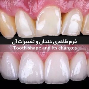 فرم ظاهری دندان و تغییرات آن